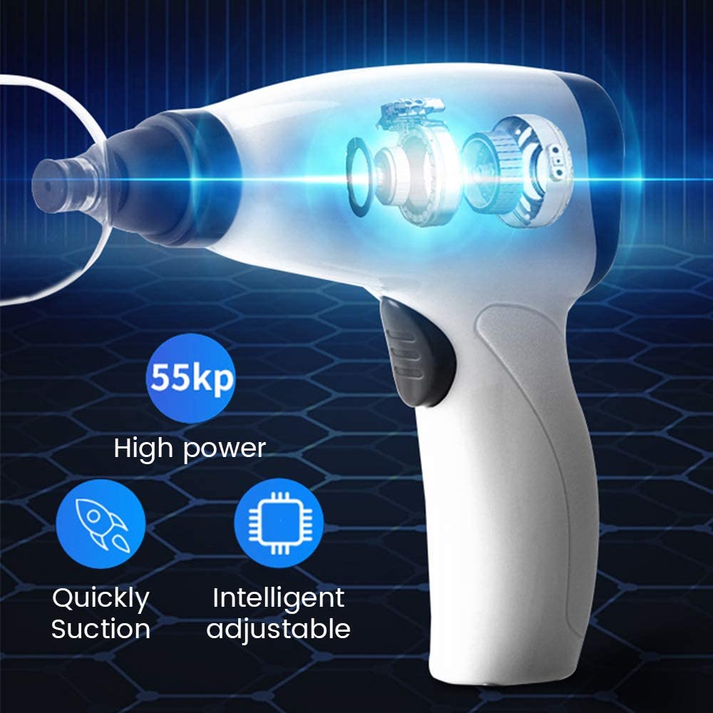 Suction Cup AntiCellulite Elec - огляд і ціна Cupping Therapy Set