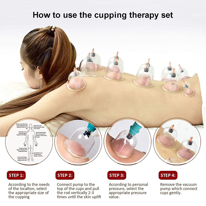 6or24  Pieces Suction Cups Mas - огляд і ціна Cupping Therapy Set