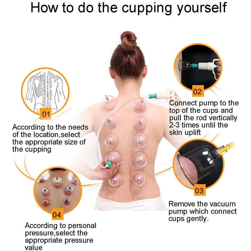 6or24  Pieces Suction Cups Mas - огляд і ціна Cupping Therapy Set