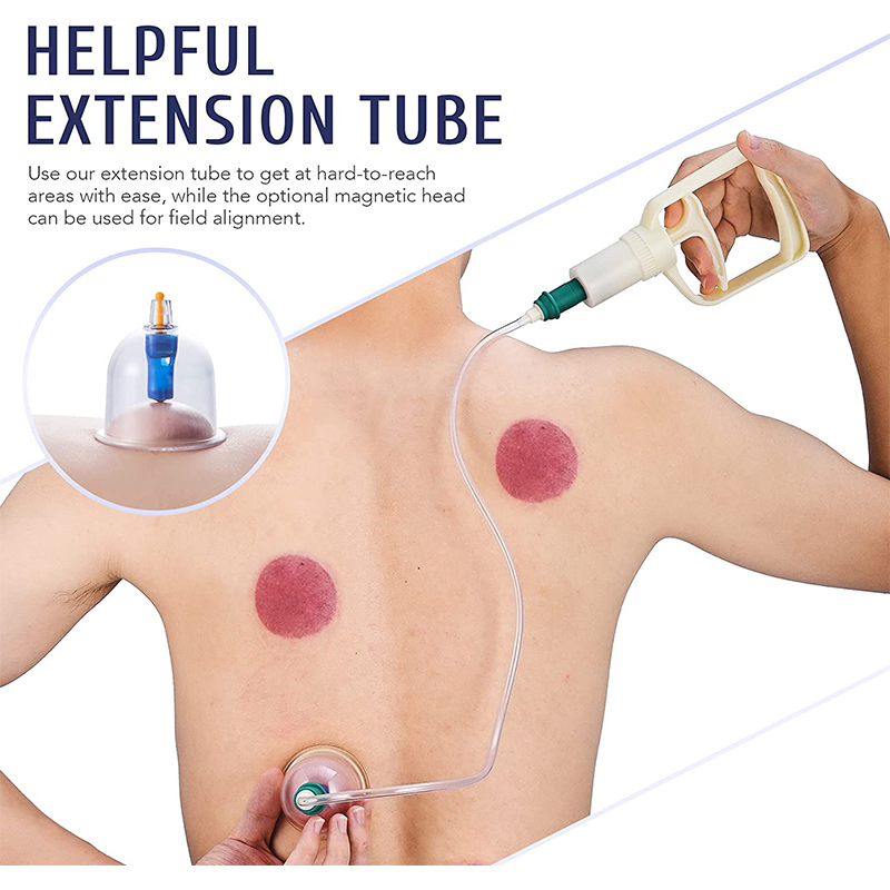 6or24  Pieces Suction Cups Mas - огляд і ціна Cupping Therapy Set