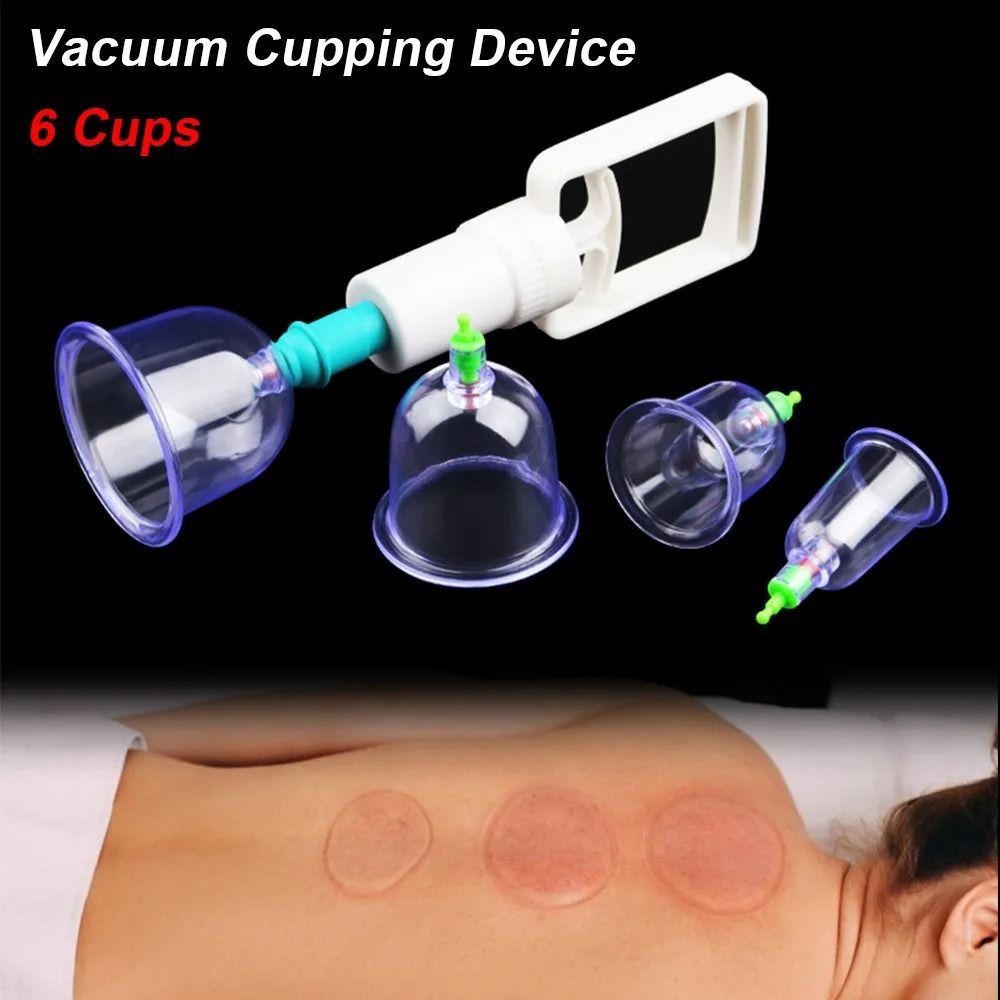 8Pcs/Set Anti-cellulite Vacuum - огляд і ціна Cupping Therapy Set