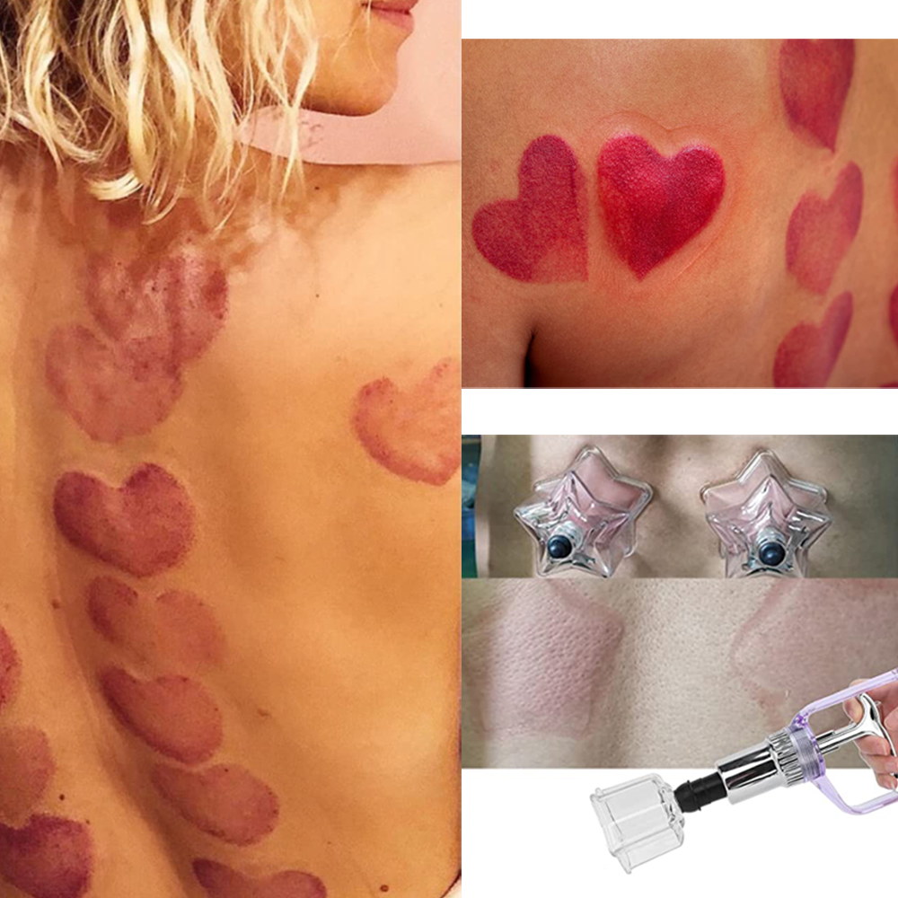 New Style 4 PCS Love-star Shap - огляд і ціна Cupping Therapy Set